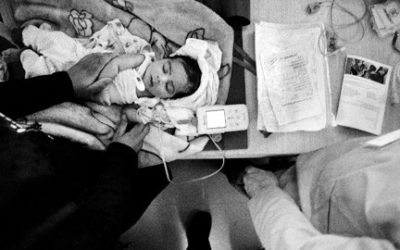 Le foto di Giles Duley all'Emergency Infopoint di Torino. Identificazione di una ferita.